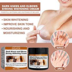 Whitening Cream for Dark Knuckle Finger Elbow and Knee