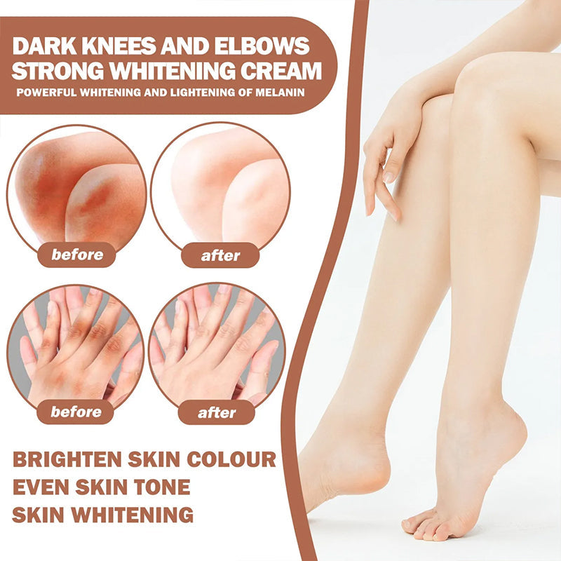 Whitening Cream for Dark Knuckle Finger Elbow and Knee