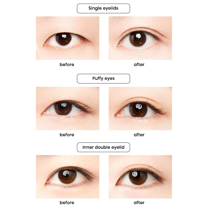 Invisible Eyelid Strips Kit