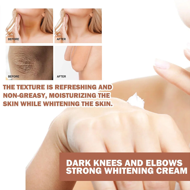 Whitening Cream for Dark Knuckle Finger Elbow and Knee